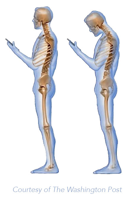How To Avoid Kyphosis: Causes, Prevention, & At Home Exercises